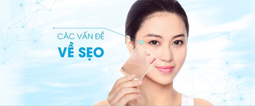 Cách trị sẹo lõm bằng công nghệ hiện đại thường gây đau đớn và tốn kém